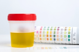 Designing an Effective Drug Testing Policy: Tips for Employers